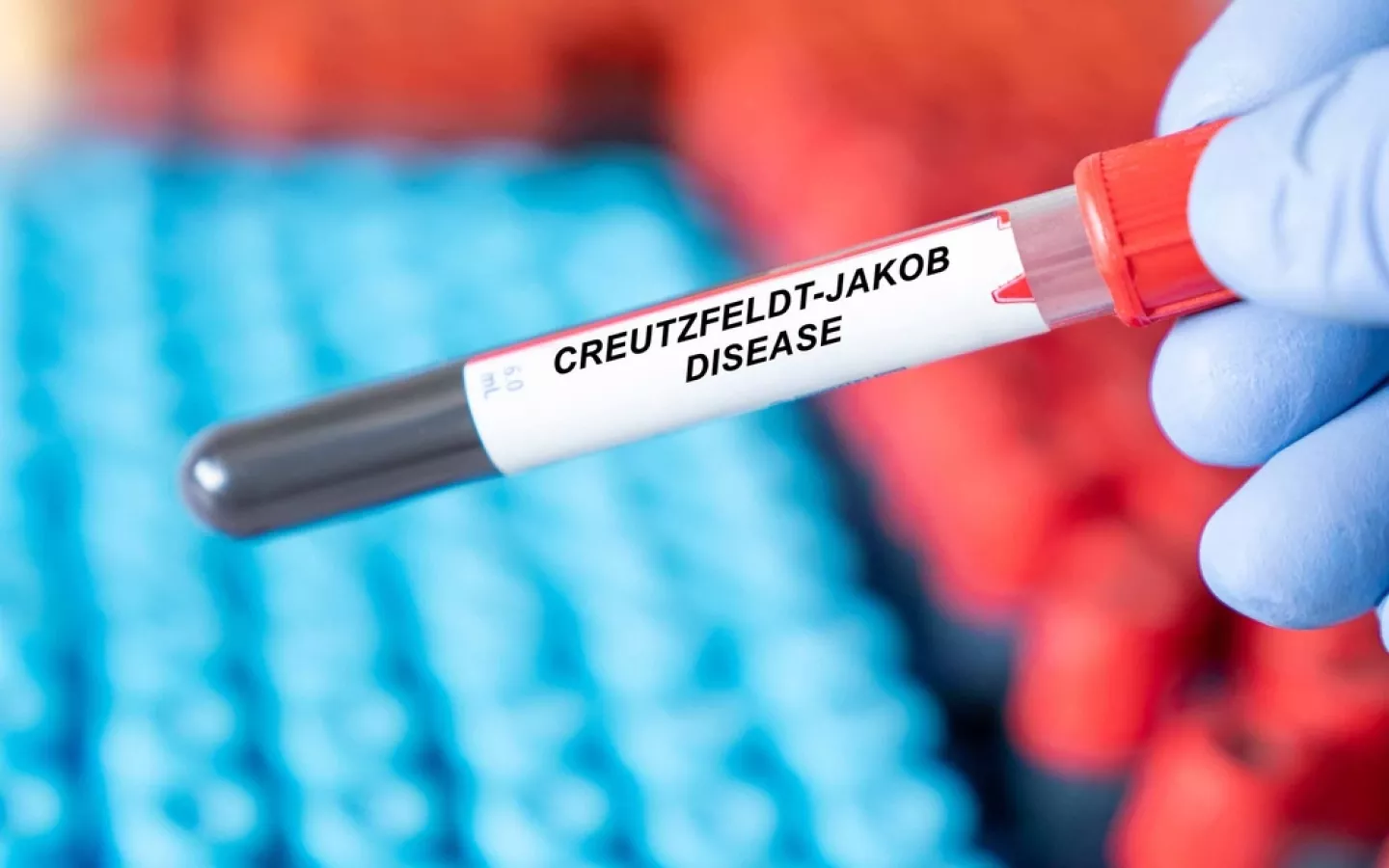 La maladie de CreutzfeldtJakob symptômes et traitements